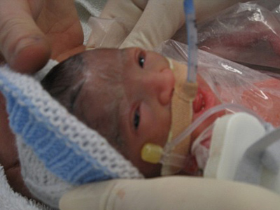 Nace beba dos días después de morir su madre