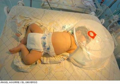 En Canadá le quitaron el respirador a un bebé para donar su corazón y sobrevive