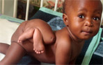 Nace en África una niña con cuatro piernas