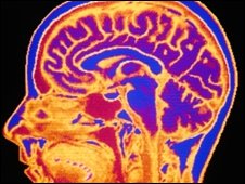 La gran mentira de los medicamentos contra la depresión: científica británica dice que nadie sabe lo que pasa en el cerebro