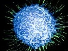 Un virus vinculado al cáncer de próstata