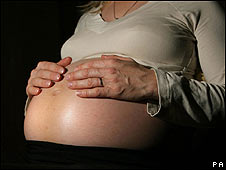 Alertan a futuras madres sobre tratamiento para fibromas