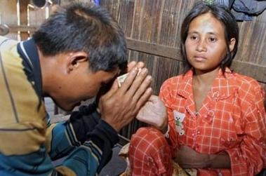 La 'mujer de la jungla' camboyana hospitalizada por negarse a comer
