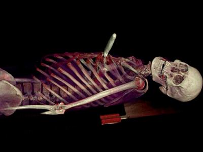 Peligra trabajo de forenses: Una "autopsia virtual" determina la causa de muerte sin abrir el cuerpo