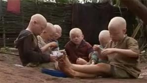 Cacería humana: 10.000 albinos se meten "bajo tierra" para que no se los coman en Africa