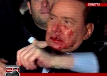 Berlusconi hospitalizado por agresión en Milán