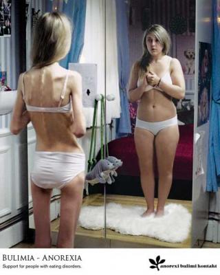 España: alertan del aumento de casos de anorexia y bulimia en niñas de 12 y 13 años