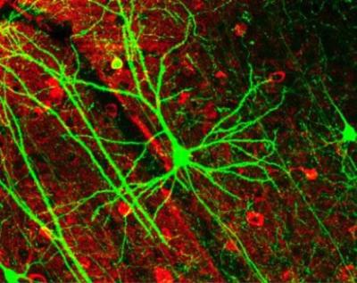 Convierten células de la piel en neuronas