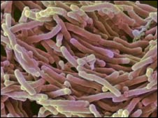 La tuberculosis más letal que nunca