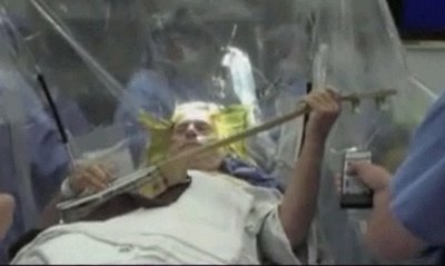 Operan el cerebro de un violinista mientras toca para eliminar el temblor de sus manos