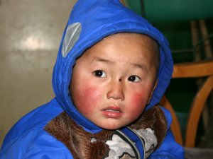 Un niño chino se salva de morir gracias a sus orejas