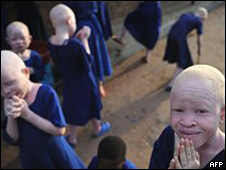 Detenido por intentar vender a un albino en Tanzania
