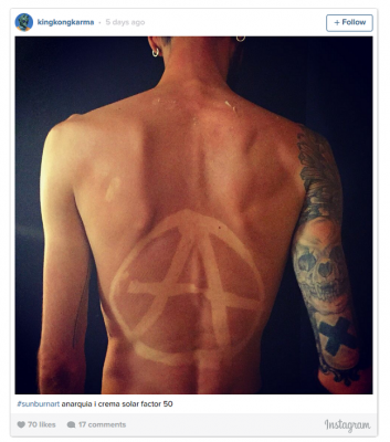 La peligrosa moda de los tatuajes solares que alarma a los dermatólogos