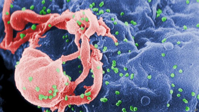 El singular caso de remisión del VIH en una joven que dejó la medicación hace 12 años