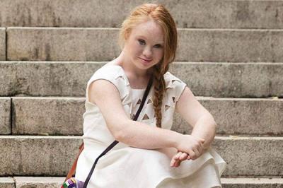 Esta niñas con Síndrome de Down se convierten en rostros de la moda en EE.UU.