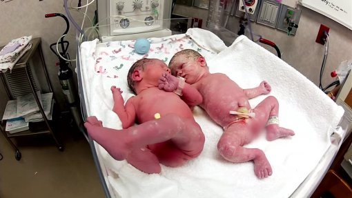 El emotivo reencuentro de dos gemelos luego de su nacimiento