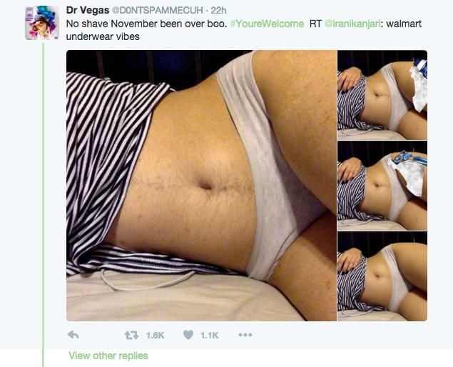 Una mujer comparte foto de su barriga con vello e Internet se pone patas arriba