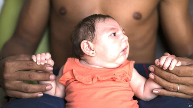 EEUU recomienda a embarazadas no viajar a 14 países por el virus zika