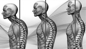 Tres músculos que no sabías que te alteran la postura