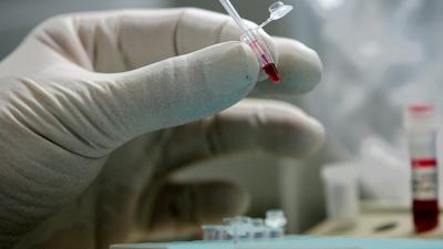 Los científicos alertan sobre un nuevo virus mortal que amenaza al mundo