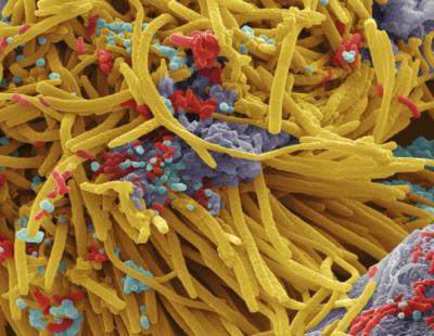 Las reveladoras imágenes de las bacterias que viven en nuestra boca