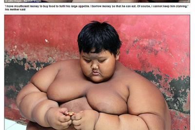 Ponen a dieta urgente al niño más obeso del mundo: su familia teme que muera