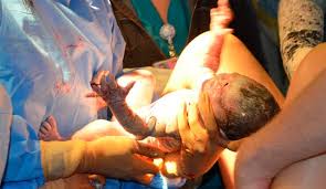 Nace un bebé de un embrión congelado durante 18 años